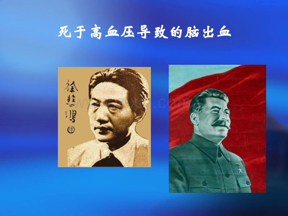 心脑血管及高血压病预防.ppt_第3页