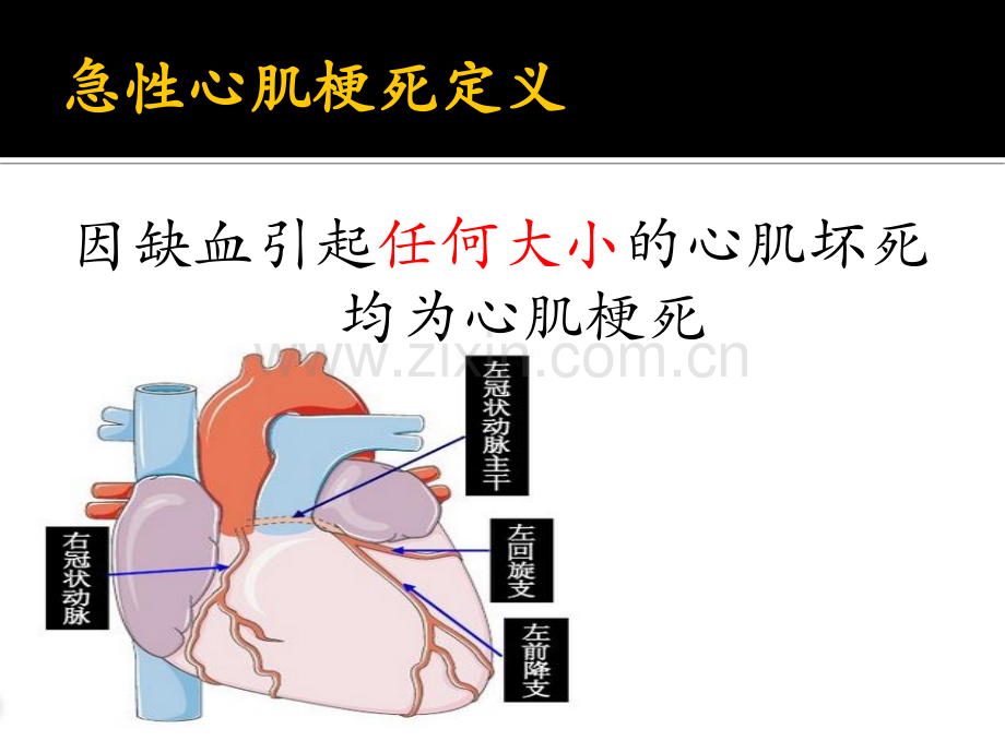 急性心肌梗死的溶栓治疗.ppt_第3页