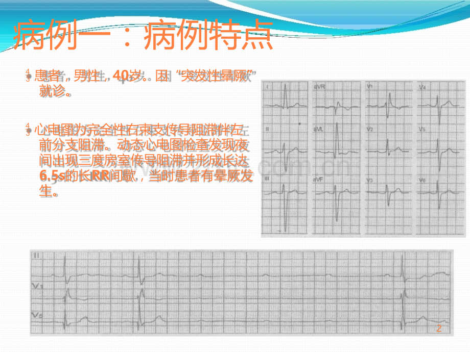 心内科典型病例讨论.ppt_第2页