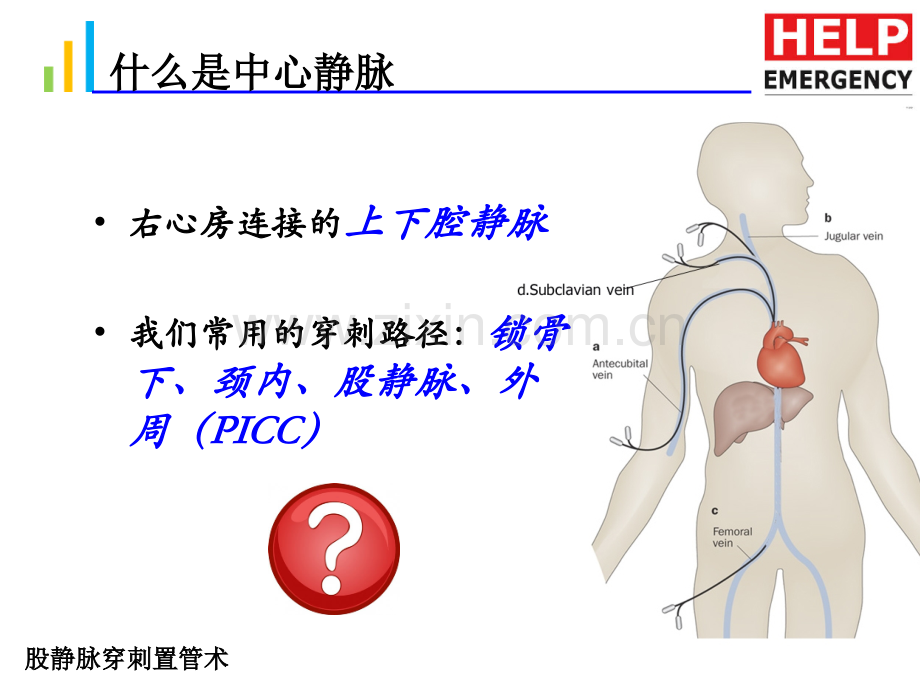 股静脉置管术.ppt_第2页