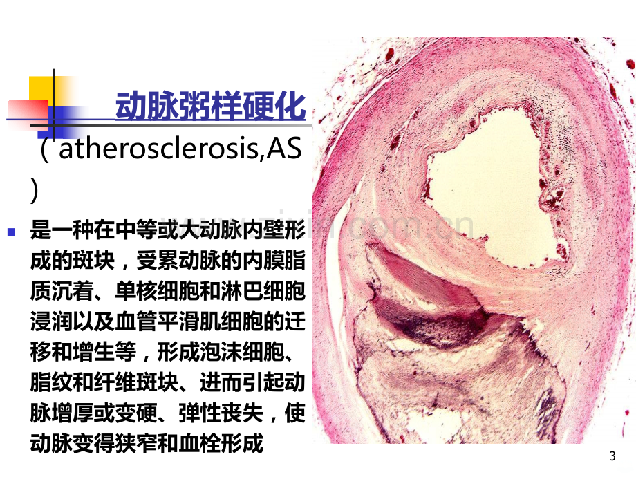 调血脂和抗动脉粥样硬化药物.ppt_第3页