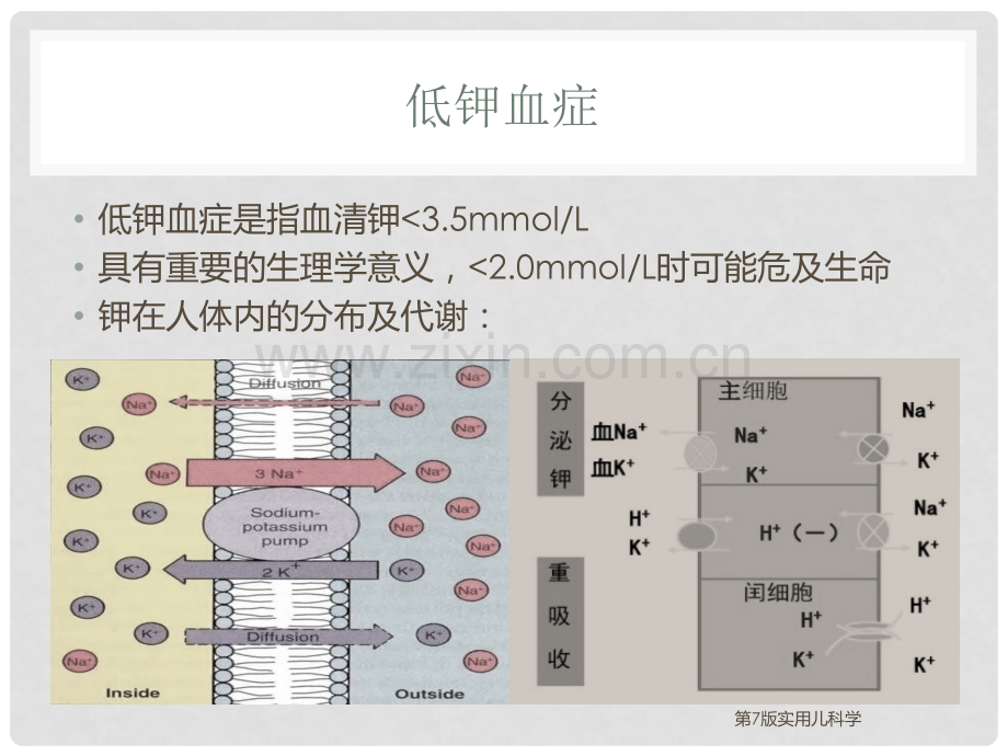 低钾血症16616.ppt_第3页