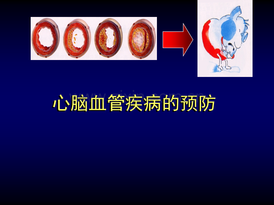 防治心脑血管疾病健康讲座(绝对实用)讲诉.ppt_第1页