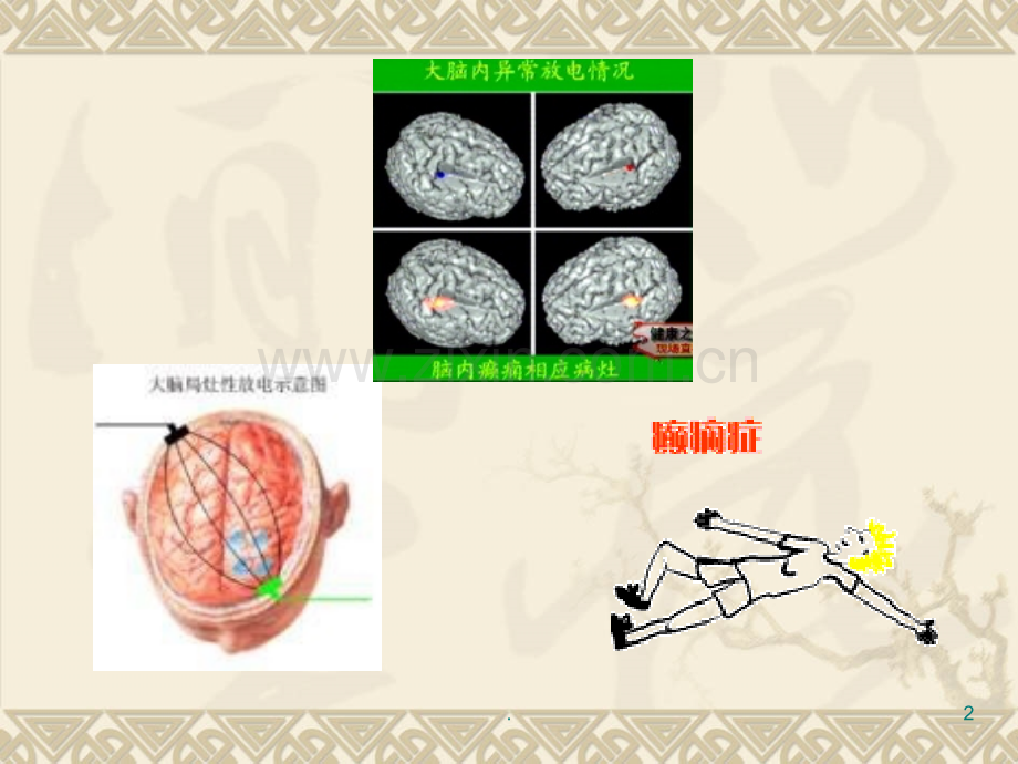 第十四抗癫痫药和抗惊厥药.ppt_第2页