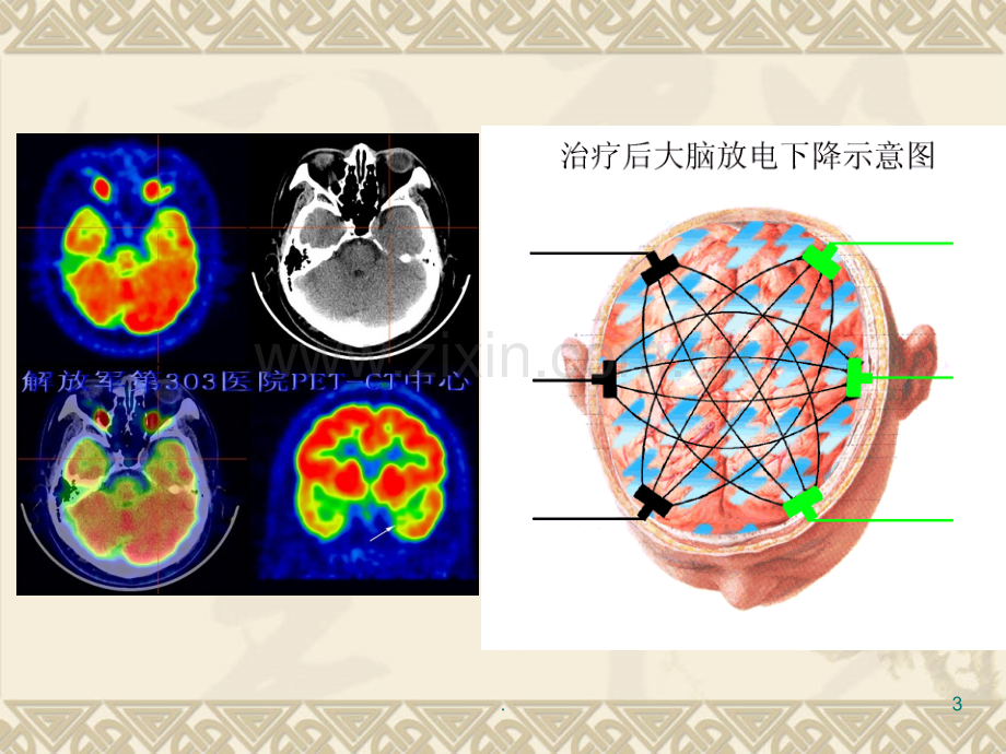 第十四抗癫痫药和抗惊厥药.ppt_第3页