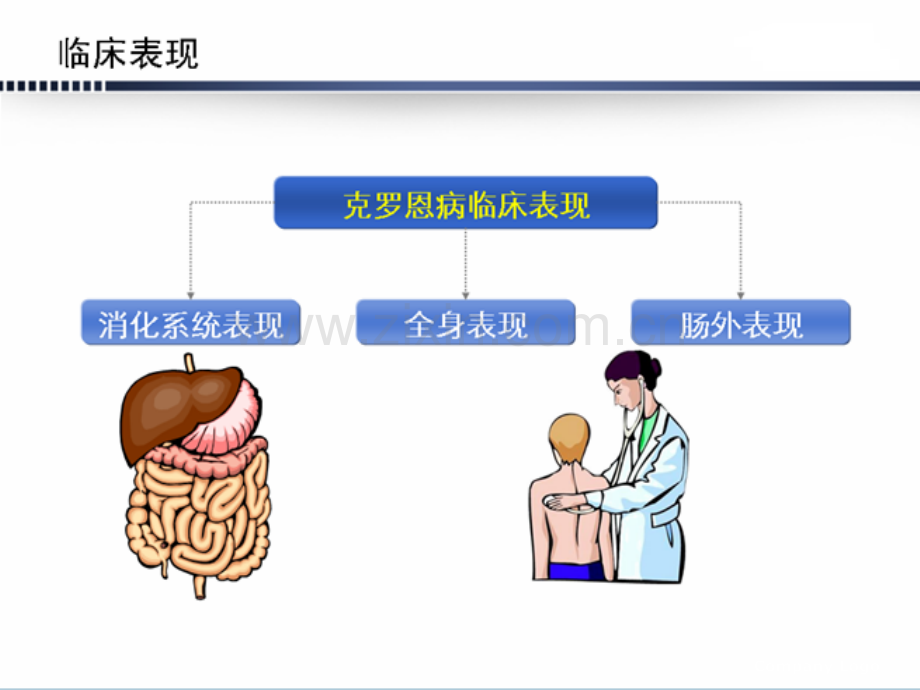 克隆恩疾病的护理.ppt_第3页