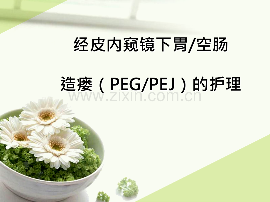 经皮内窥镜下胃空肠造瘘(PEGPEJ)的护理.ppt_第1页