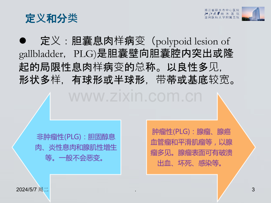 胆囊息肉外科处理思考.ppt_第3页