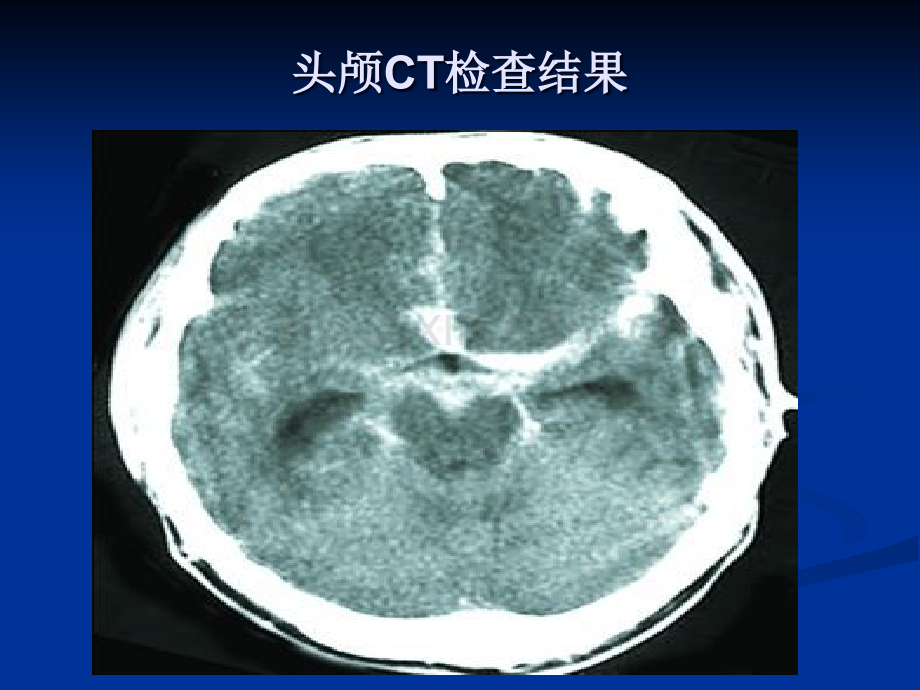 临床指南询证医学.ppt_第3页