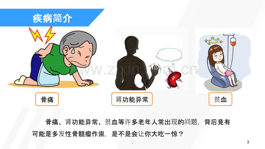 多发性骨髓瘤简介.ppt_第3页