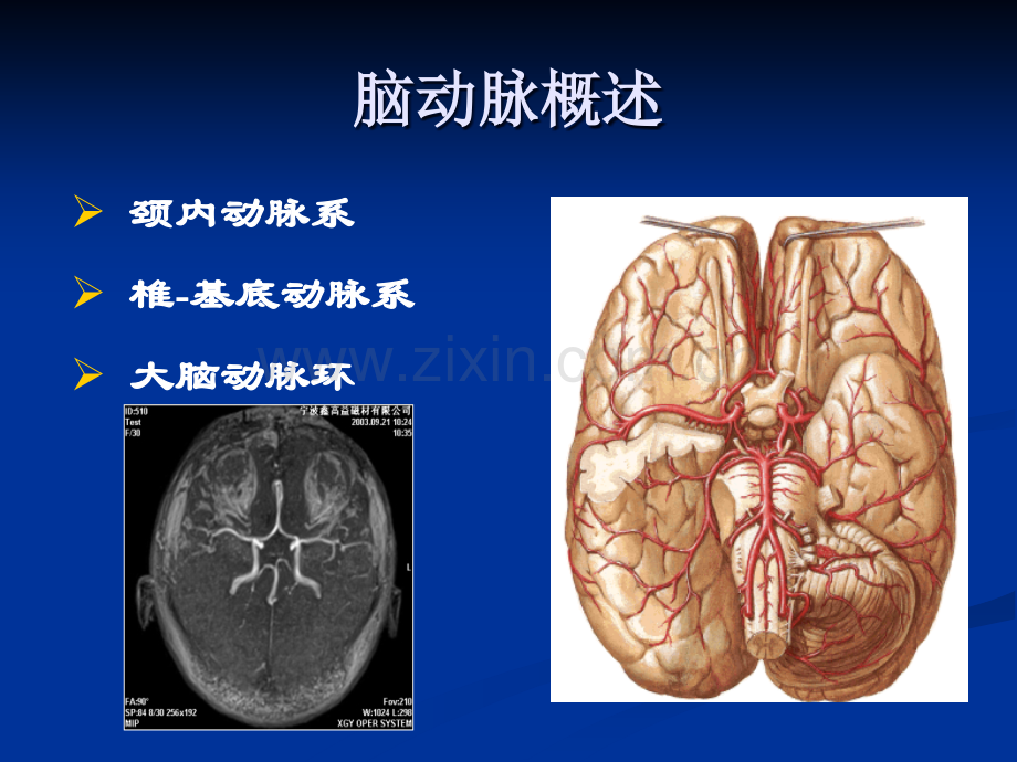 颅内和椎管内血管性疾病.ppt_第2页