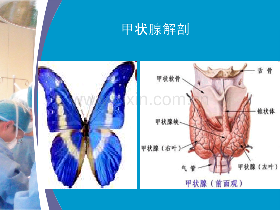 甲状腺癌根治术中喉返神经监测技术应用.ppt_第2页