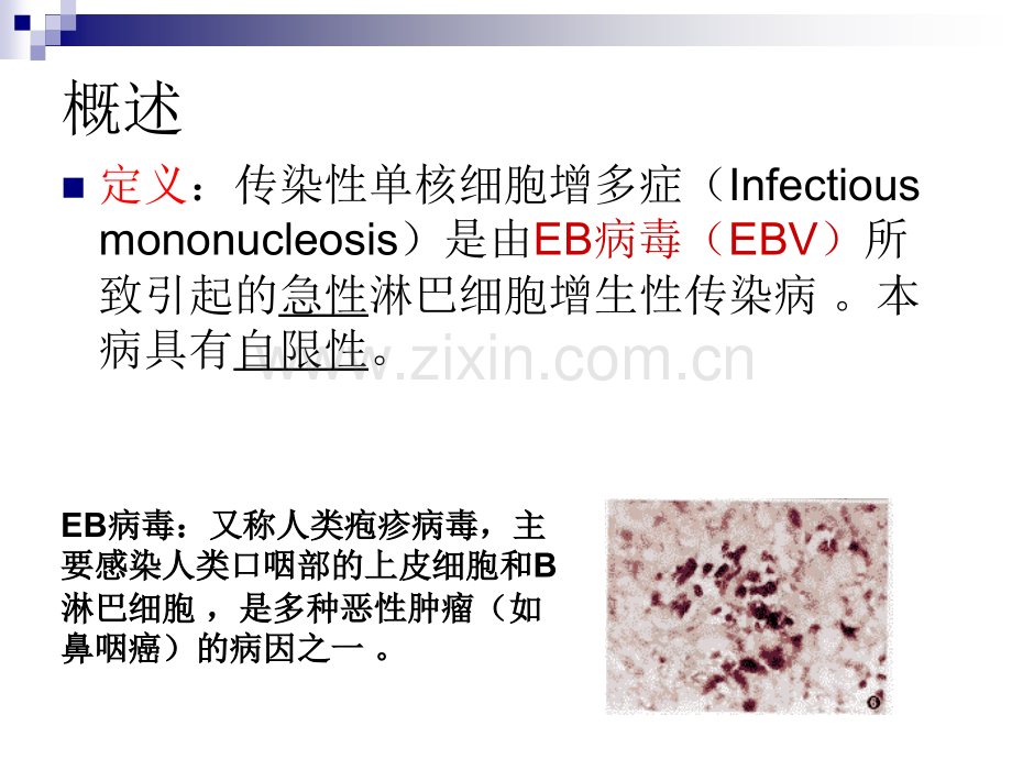 传染性单核细胞增护理查房演示课件.ppt_第3页