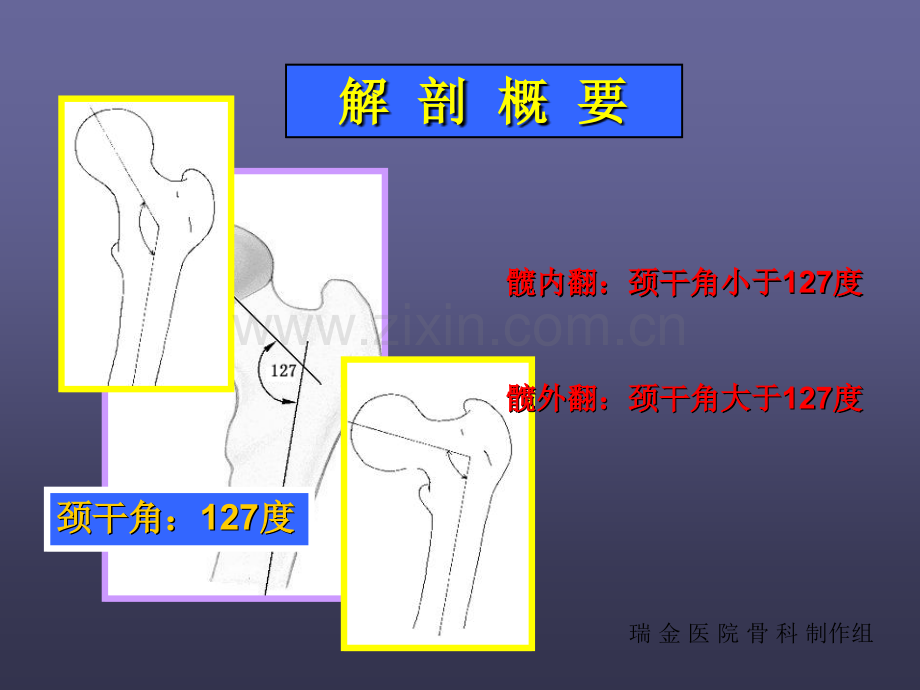 上海瑞金医院股骨颈骨折讲义.ppt_第3页