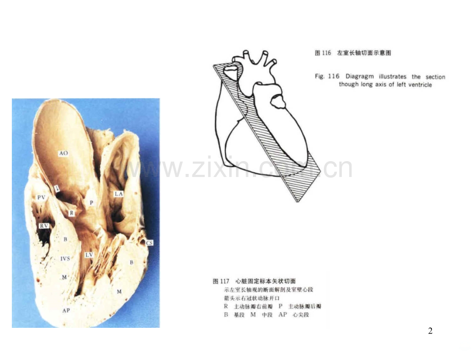 心脏断面解剖.ppt_第2页