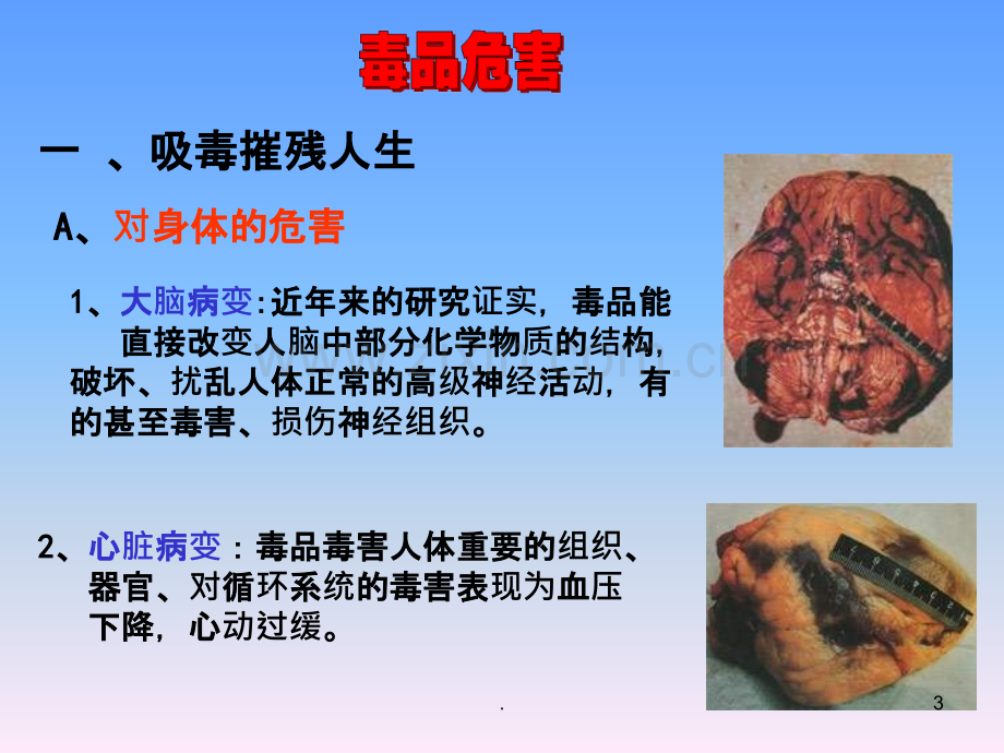 戒毒常识《珍爱生命远离毒品》].ppt_第3页