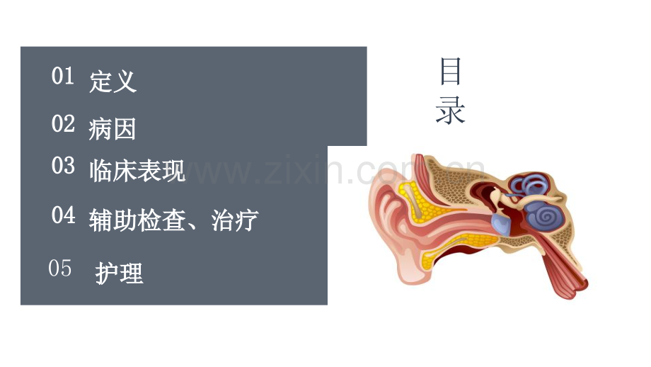 突发性耳聋.pptx_第3页