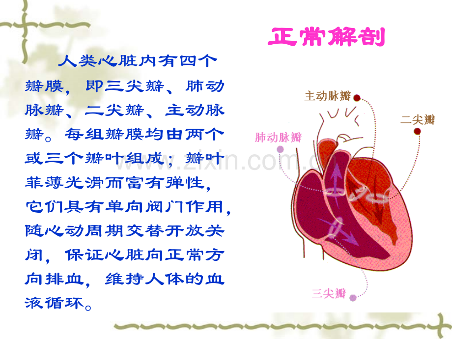 主动脉瓣置换术后的护理11.pptx_第2页