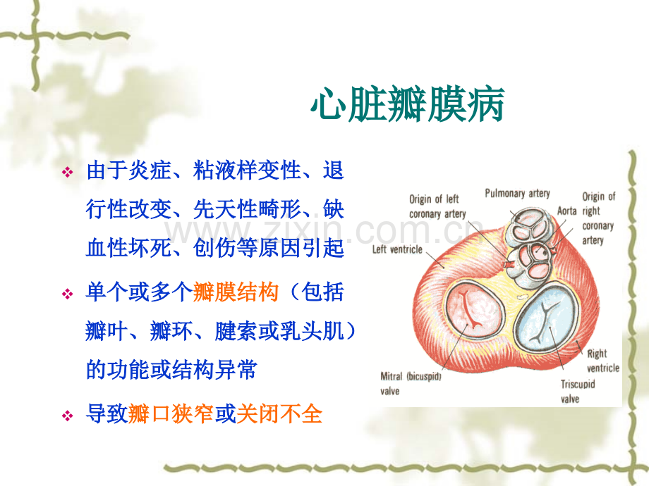 主动脉瓣置换术后的护理11.pptx_第3页