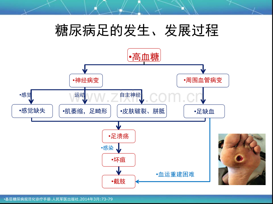 2017版中国糖尿病足诊治指南.ppt_第2页