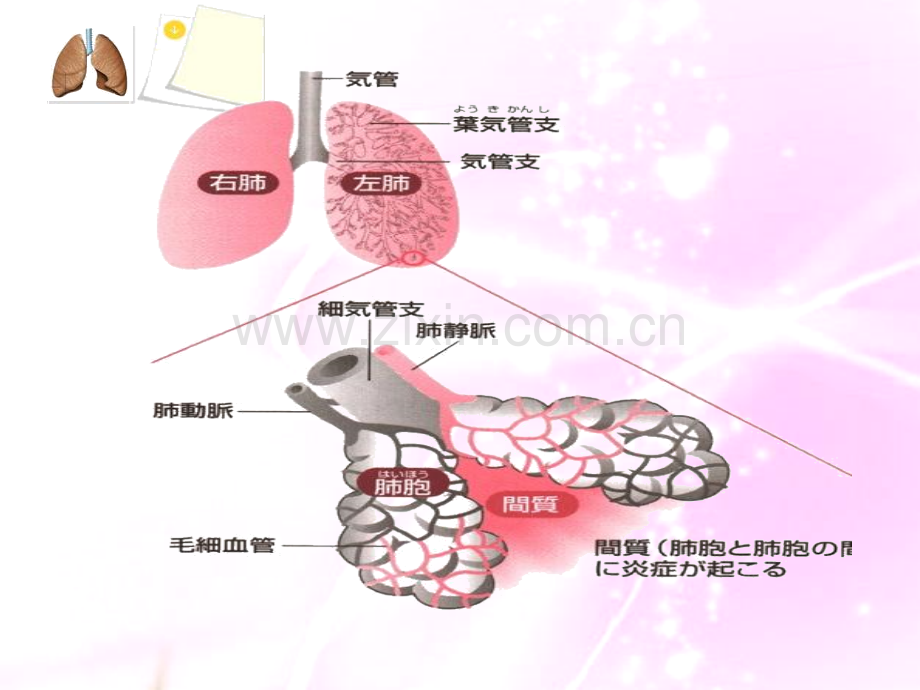 2019-肺炎病人的护理-文档资料.ppt_第3页