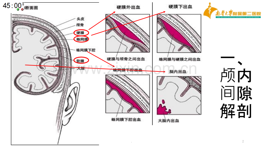 基层神经外科常见引流管介绍.ppt_第2页