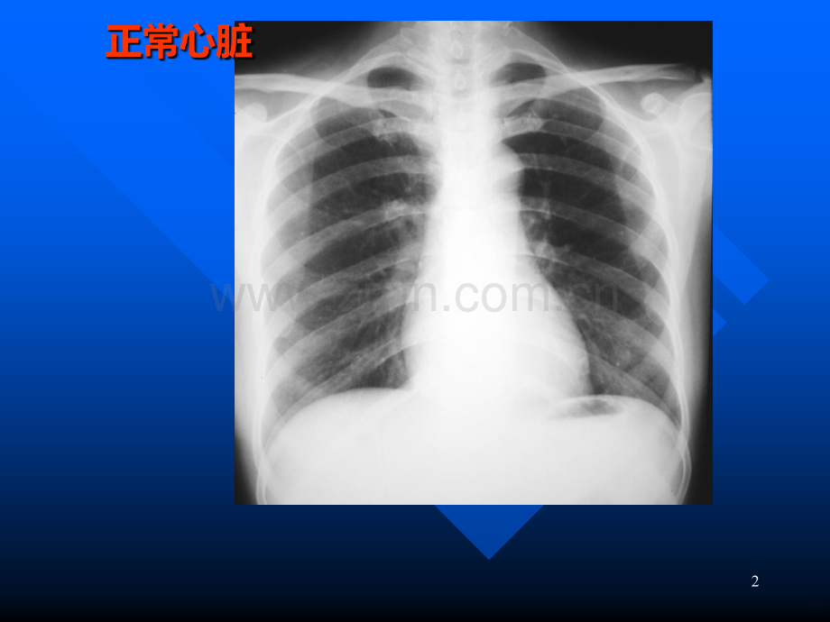 心脏常规X线检查.ppt_第2页