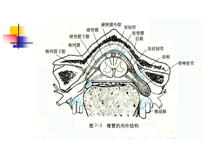 急性脊髓炎acutemyelitis一.ppt_第3页