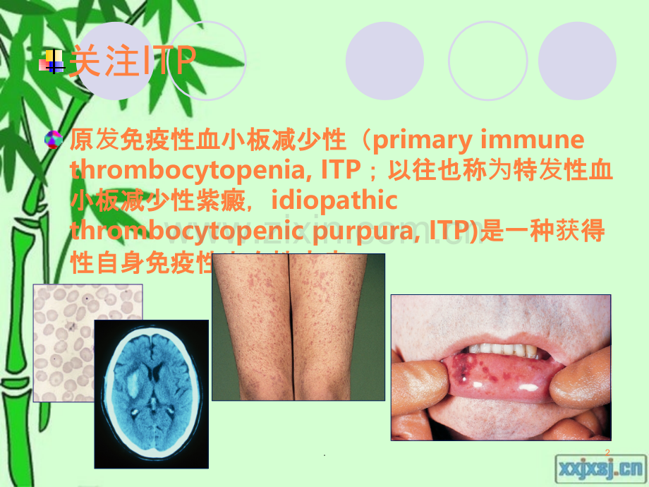 的中西医诊断与治疗.ppt_第2页