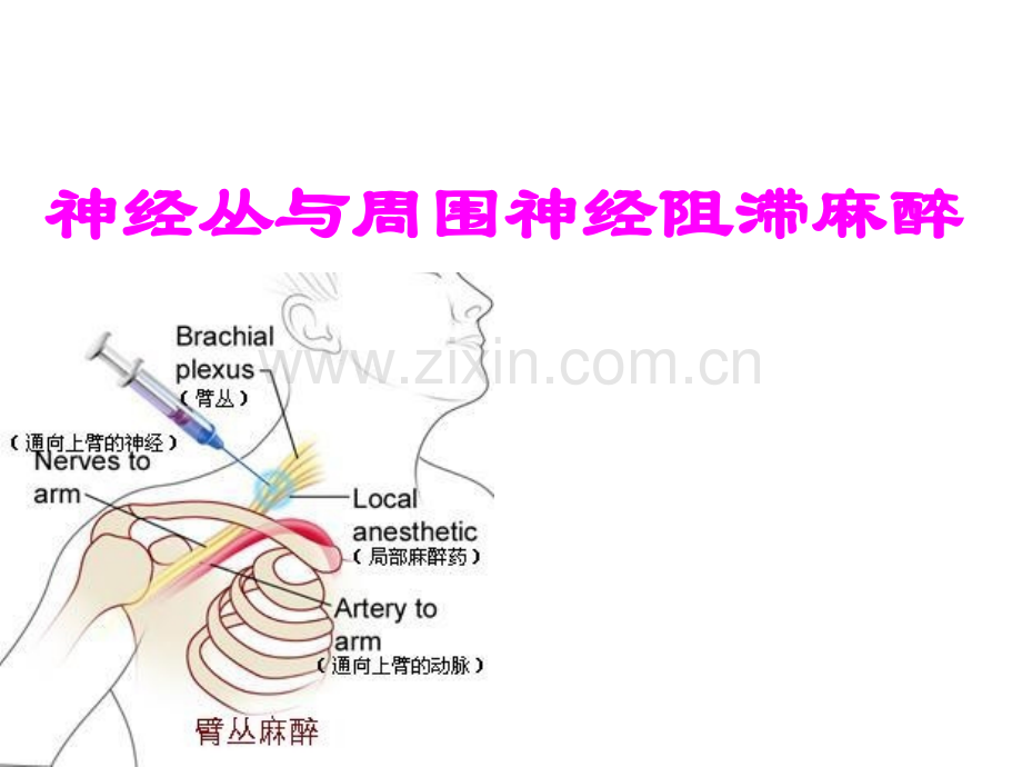 讲课稿周围神经阻滞麻醉分解.ppt_第1页