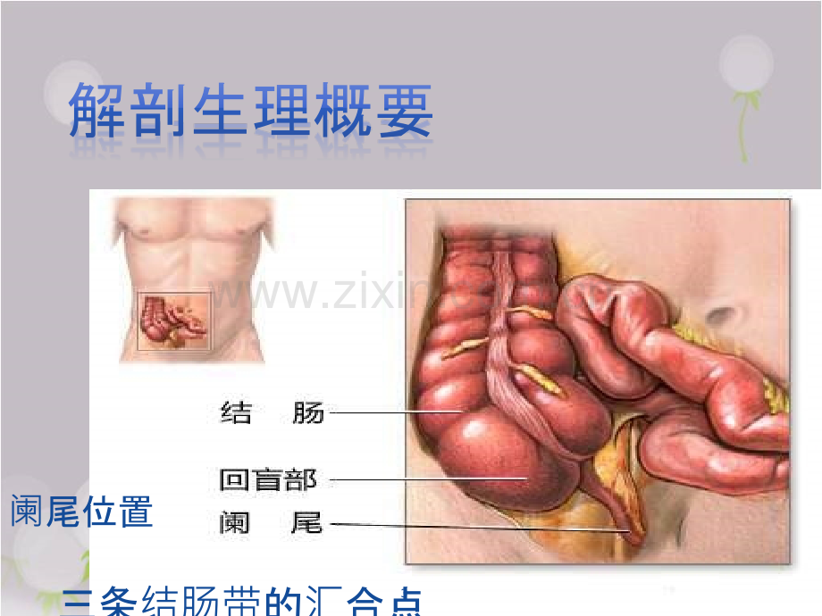 急性阑尾炎...pptx_第3页