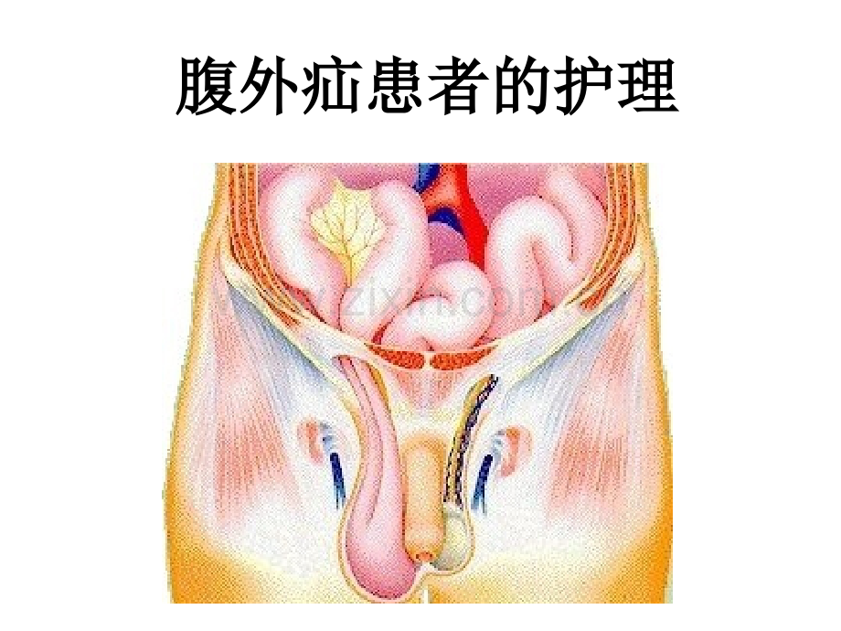 可鉴别肿物的性质鞘膜积液.ppt_第1页