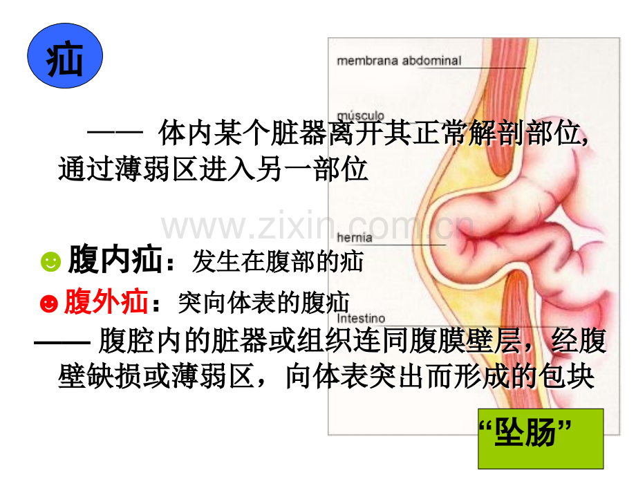 可鉴别肿物的性质鞘膜积液.ppt_第2页