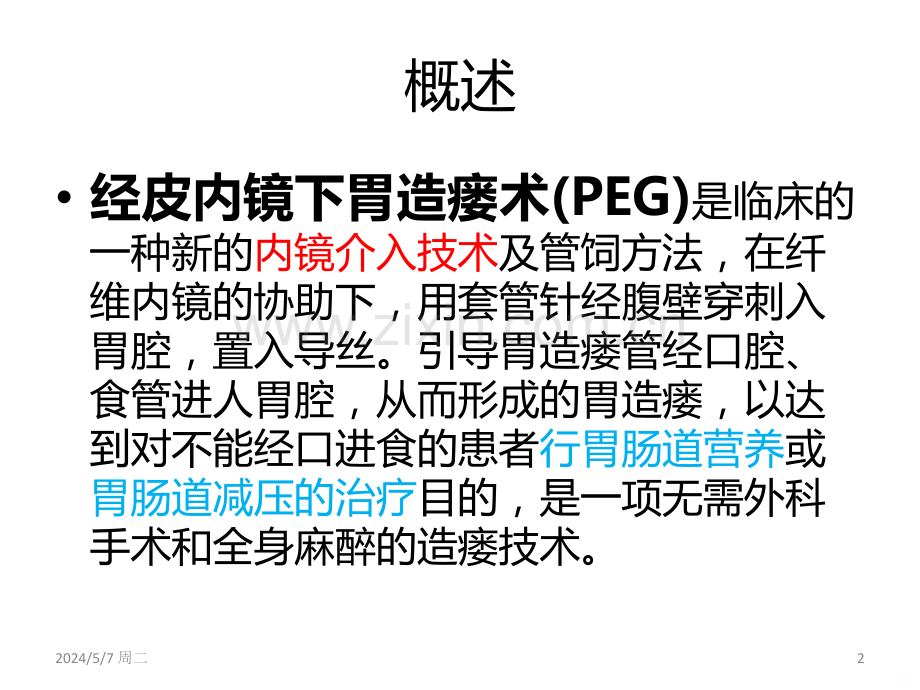 胃造瘘的诊治及护理.ppt_第2页