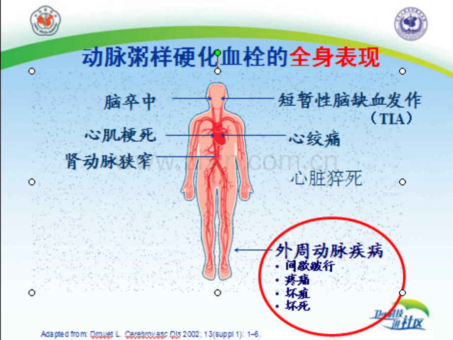 冠心病全程管理.pptx_第2页