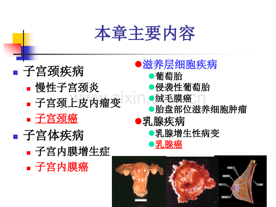 生殖系统、乳腺疾病.ppt_第2页