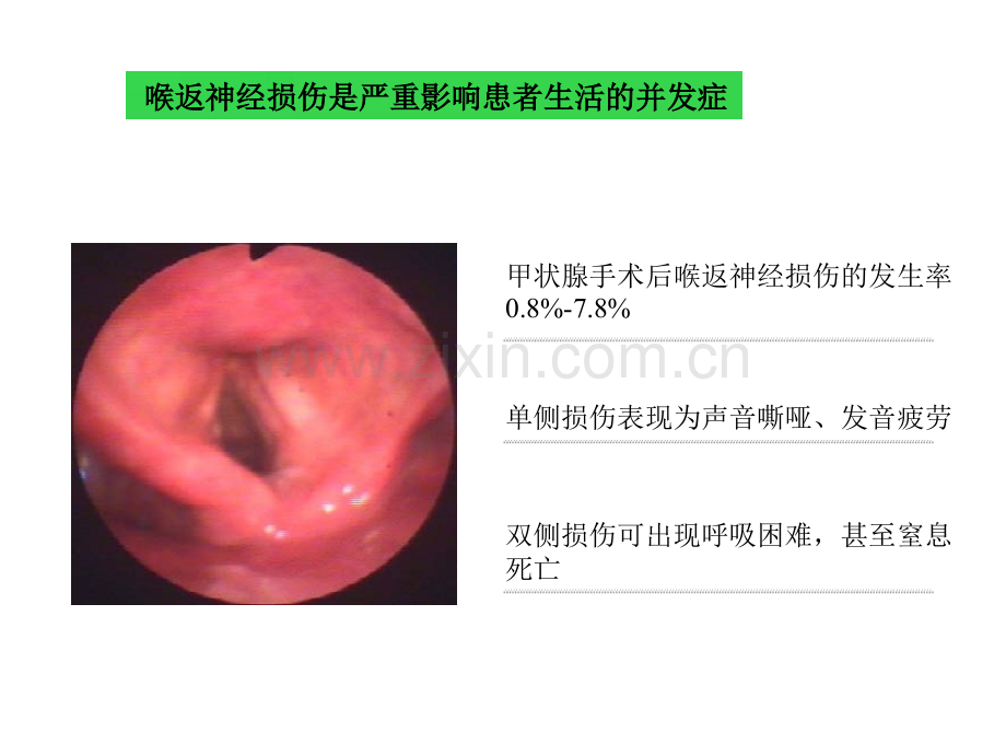 甲状腺术中喉返神经损伤的原因及教训.ppt_第2页