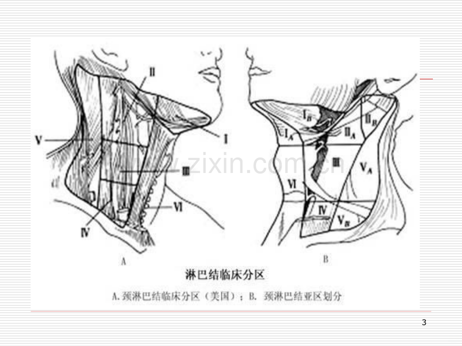 甲状腺的解剖及外科手术.ppt_第3页