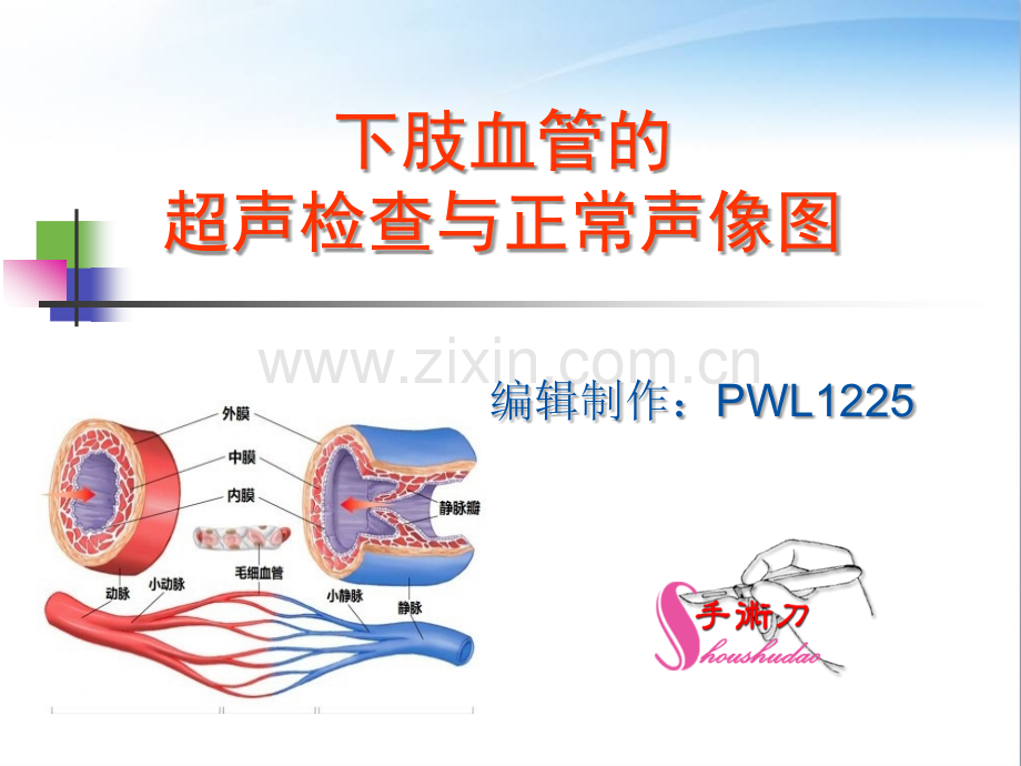 下肢血管的超声检查及正常声像图.ppt_第1页