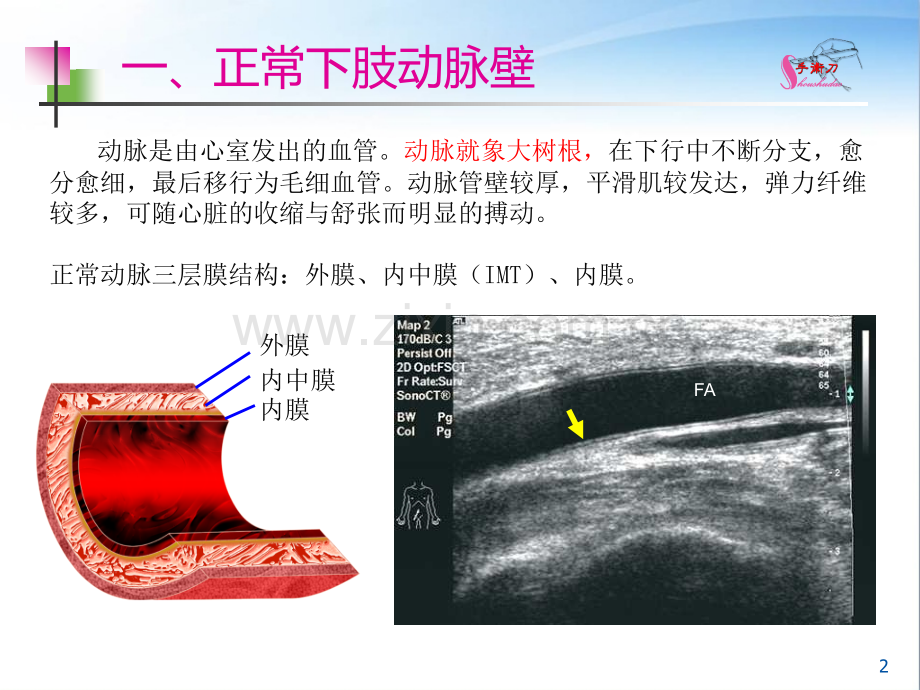 下肢血管的超声检查及正常声像图.ppt_第2页