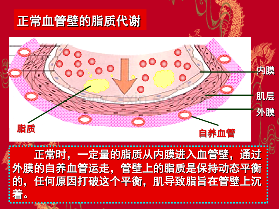 病理学课件动脉粥样硬化.ppt_第3页