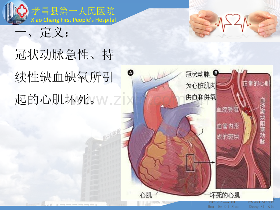 急性心肌梗死急救流程.ppt_第2页