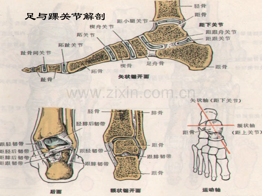 骨科个案踝关节骨折病人护理医大介绍.ppt_第3页