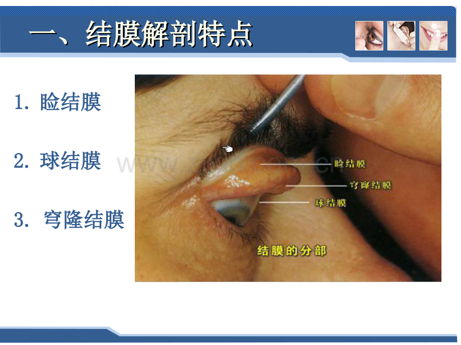 五官科学三眼科常见疾病结膜病一结膜炎.ppt_第3页