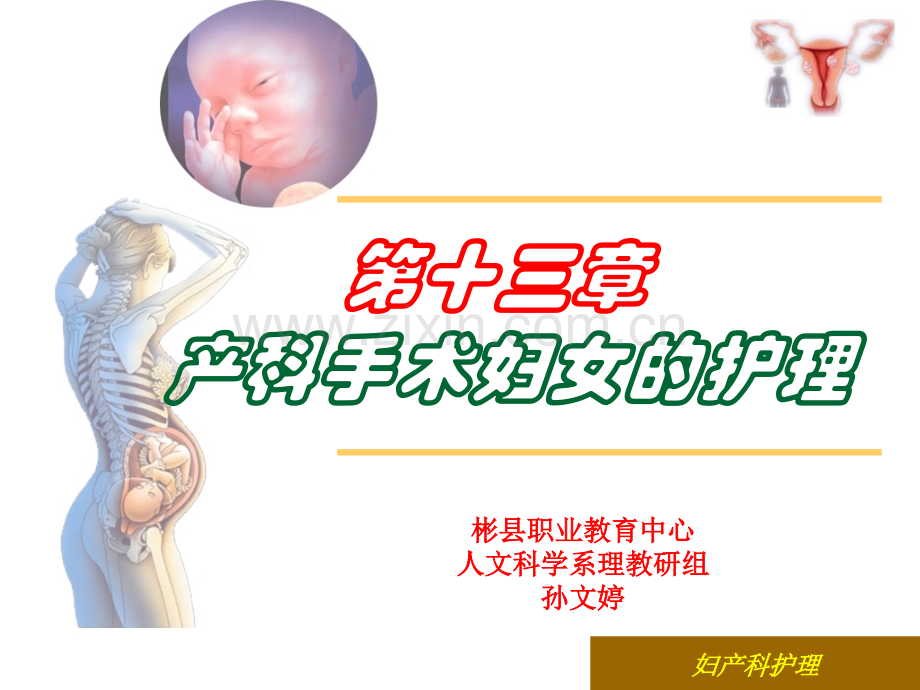 产科手术妇女的护理.ppt_第1页