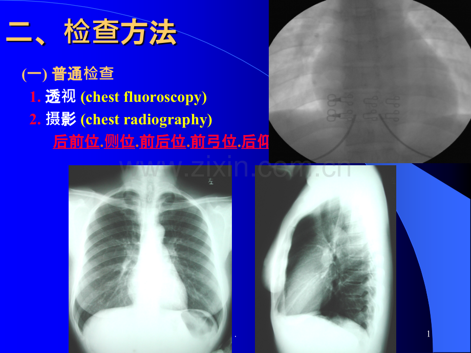 影像ppt课件.ppt_第1页