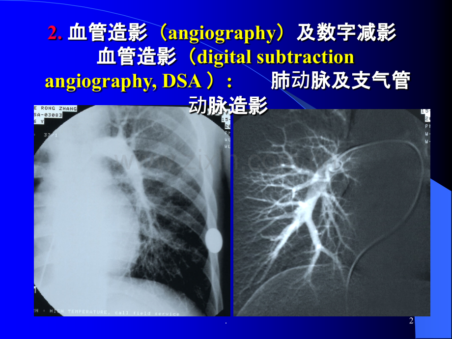 影像ppt课件.ppt_第2页