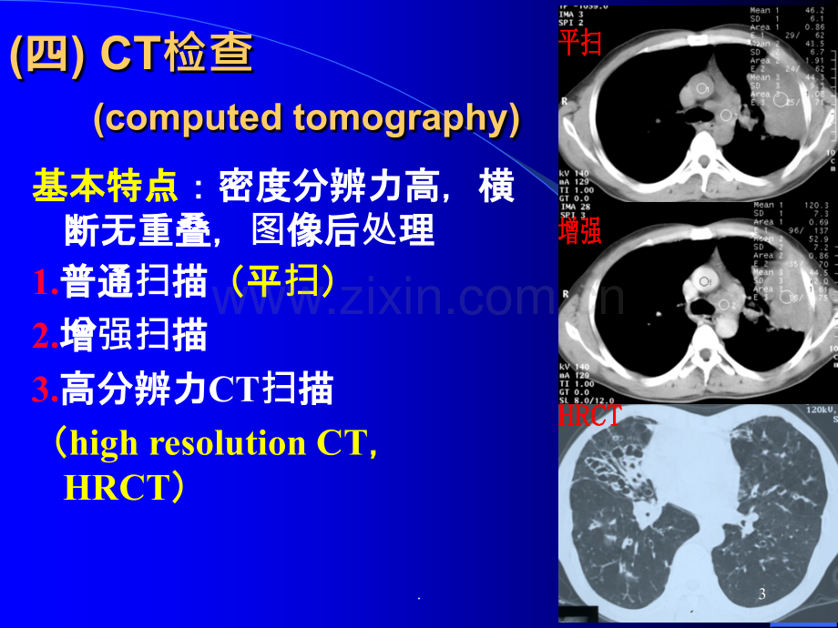 影像ppt课件.ppt_第3页