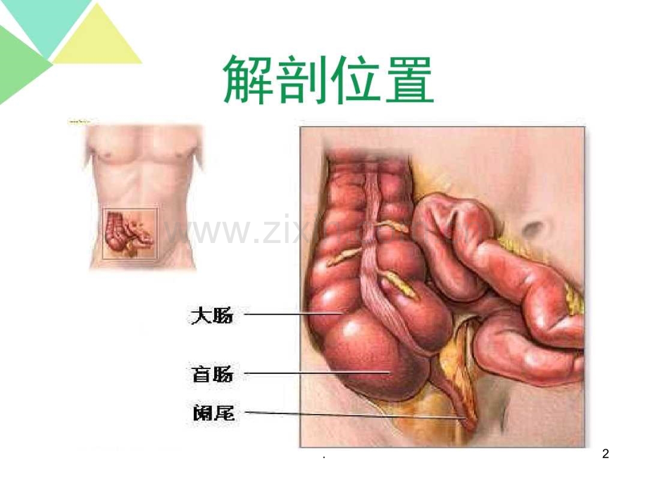 阑尾炎的术前术后护理.ppt_第2页