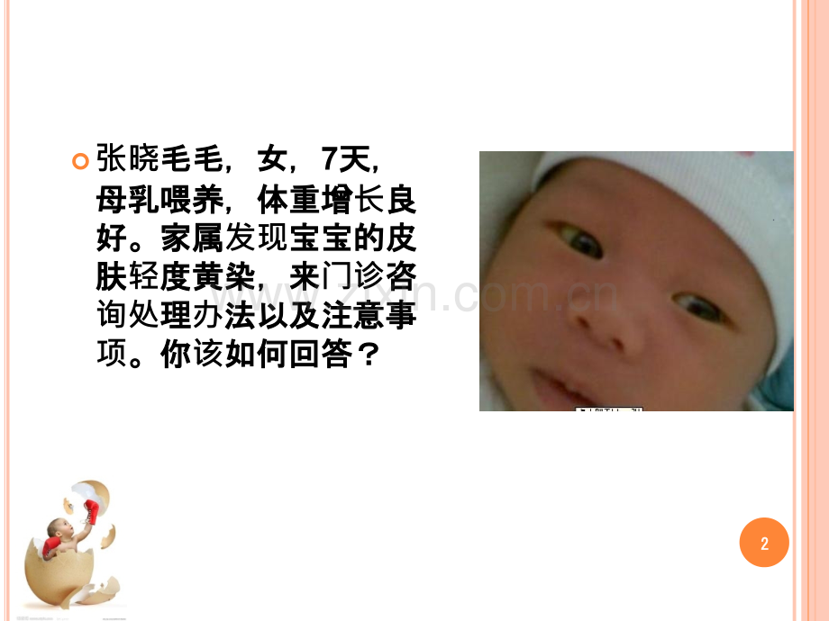 新生儿黄疸的护理.ppt_第2页